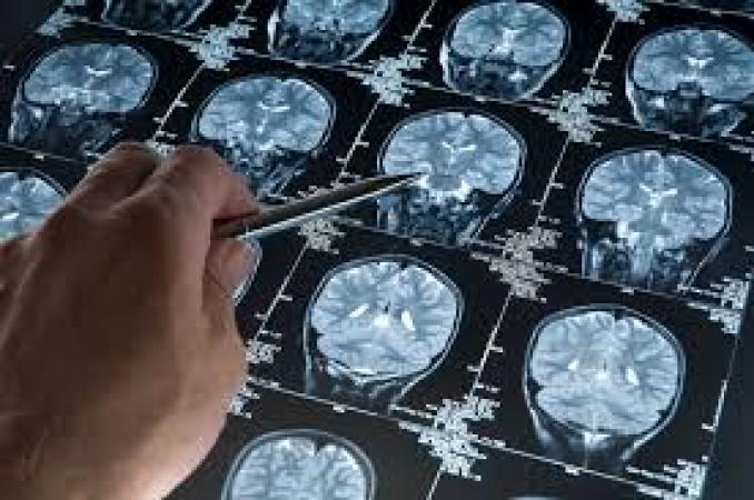 Ways to identify pediatric brain tumors early